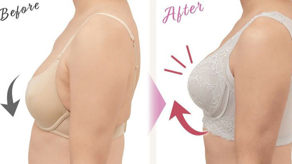 ブラ ビフォアアフター