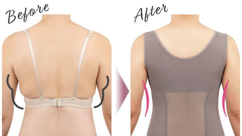 ブラキャミ ビフォアアフター