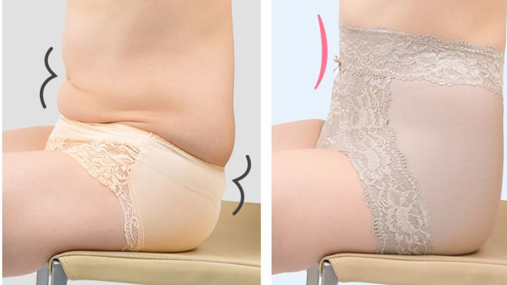 ショーツ ビフォアアフター