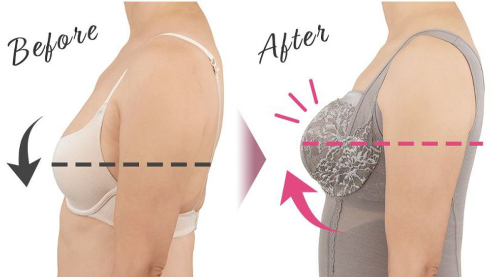 ブラキャミ ビフォアアフター