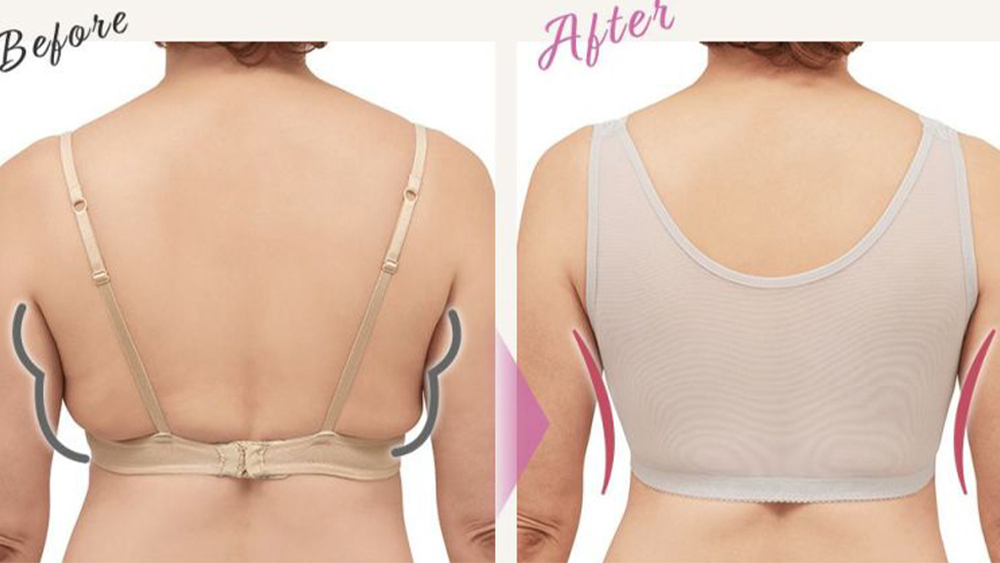 ブラ ビフォアアフター