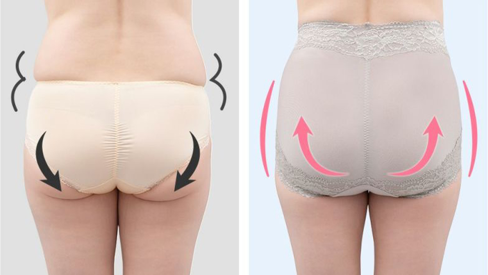 ショーツ ビフォアアフター