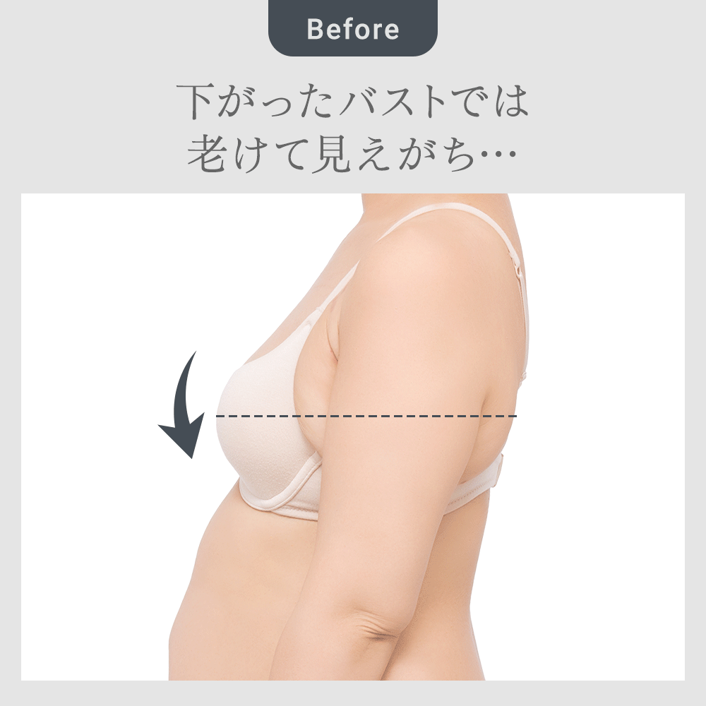 ビフォーアフター