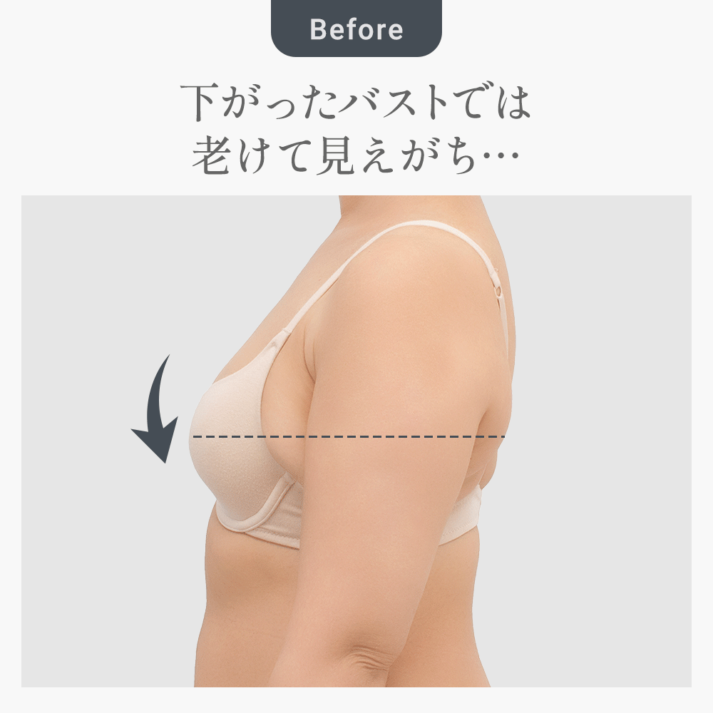 ビフォーアフター