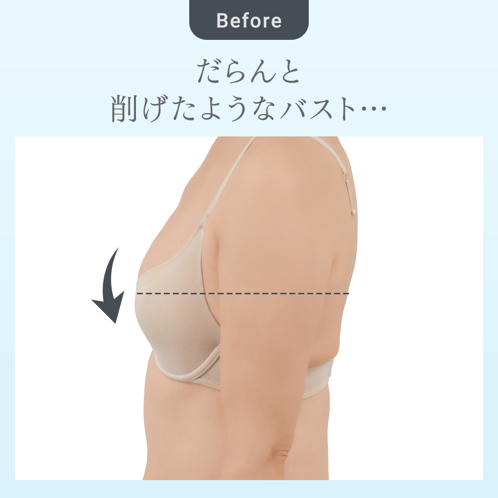 ビフォーアフター
