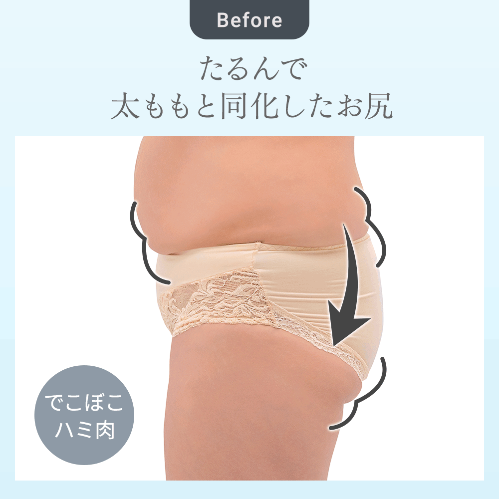 ビフォーアフター