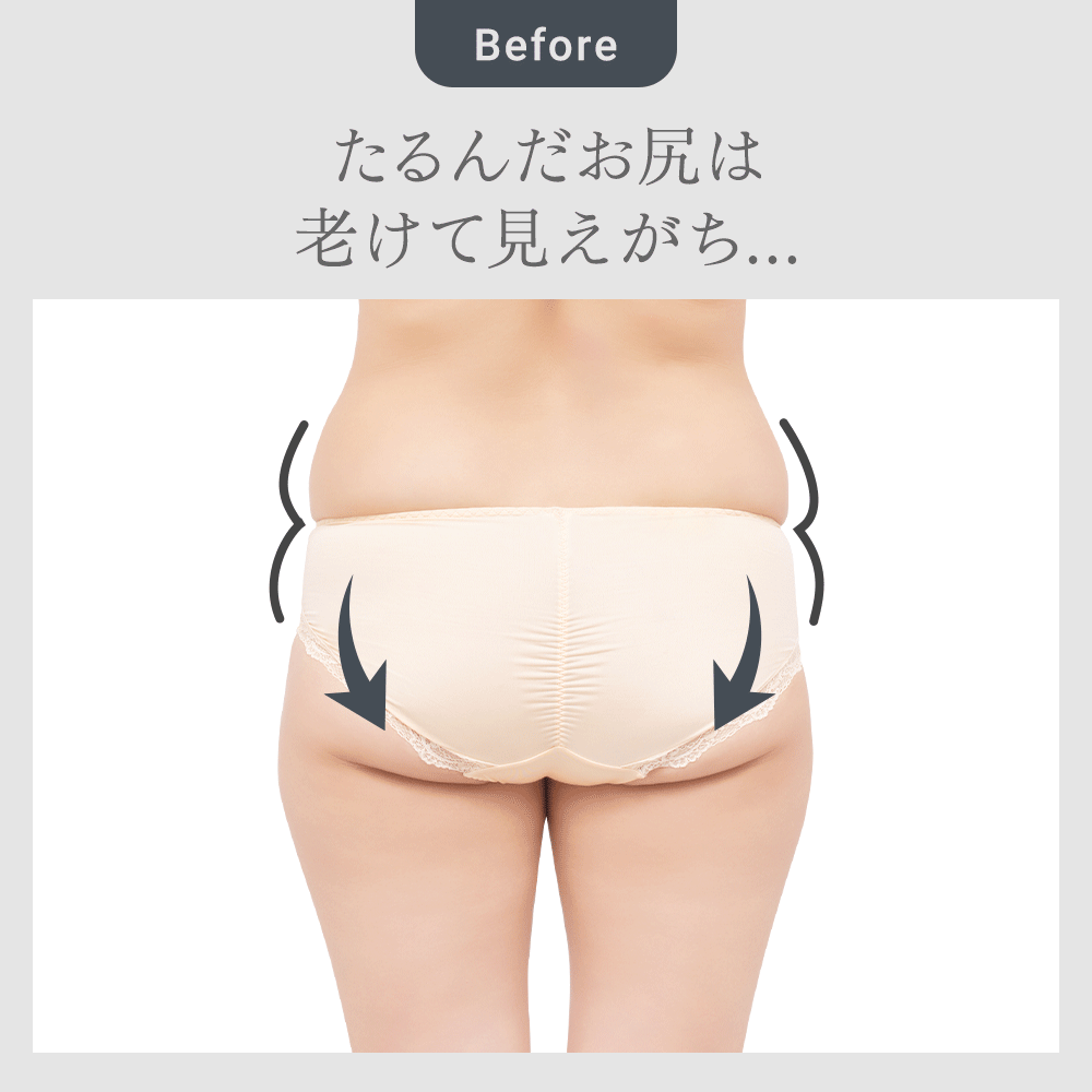 ビフォーアフター