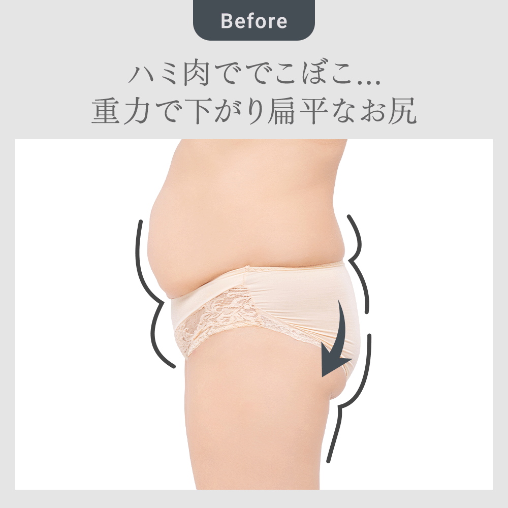 ビフォーアフター