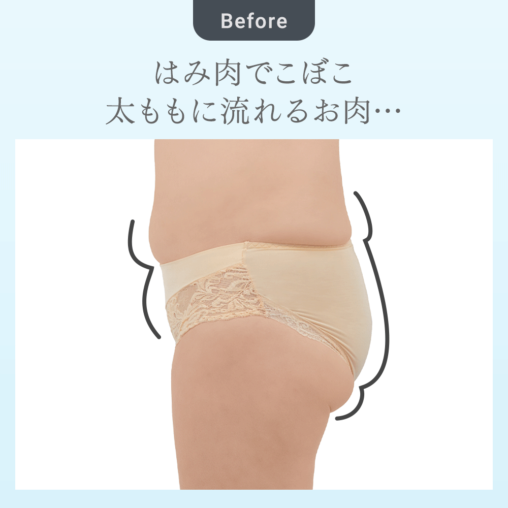 ビフォーアフター
