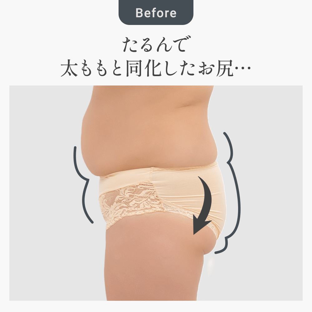 ビフォーアフター