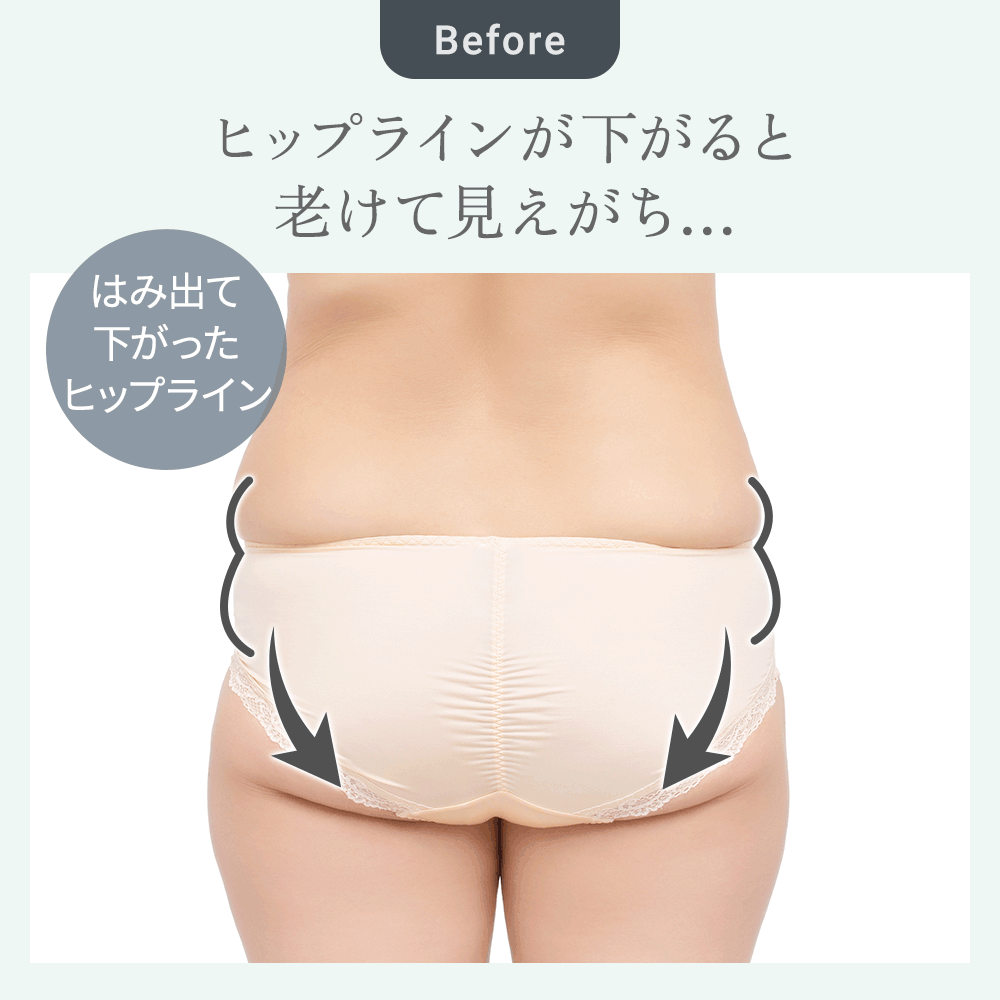 ビフォーアフター