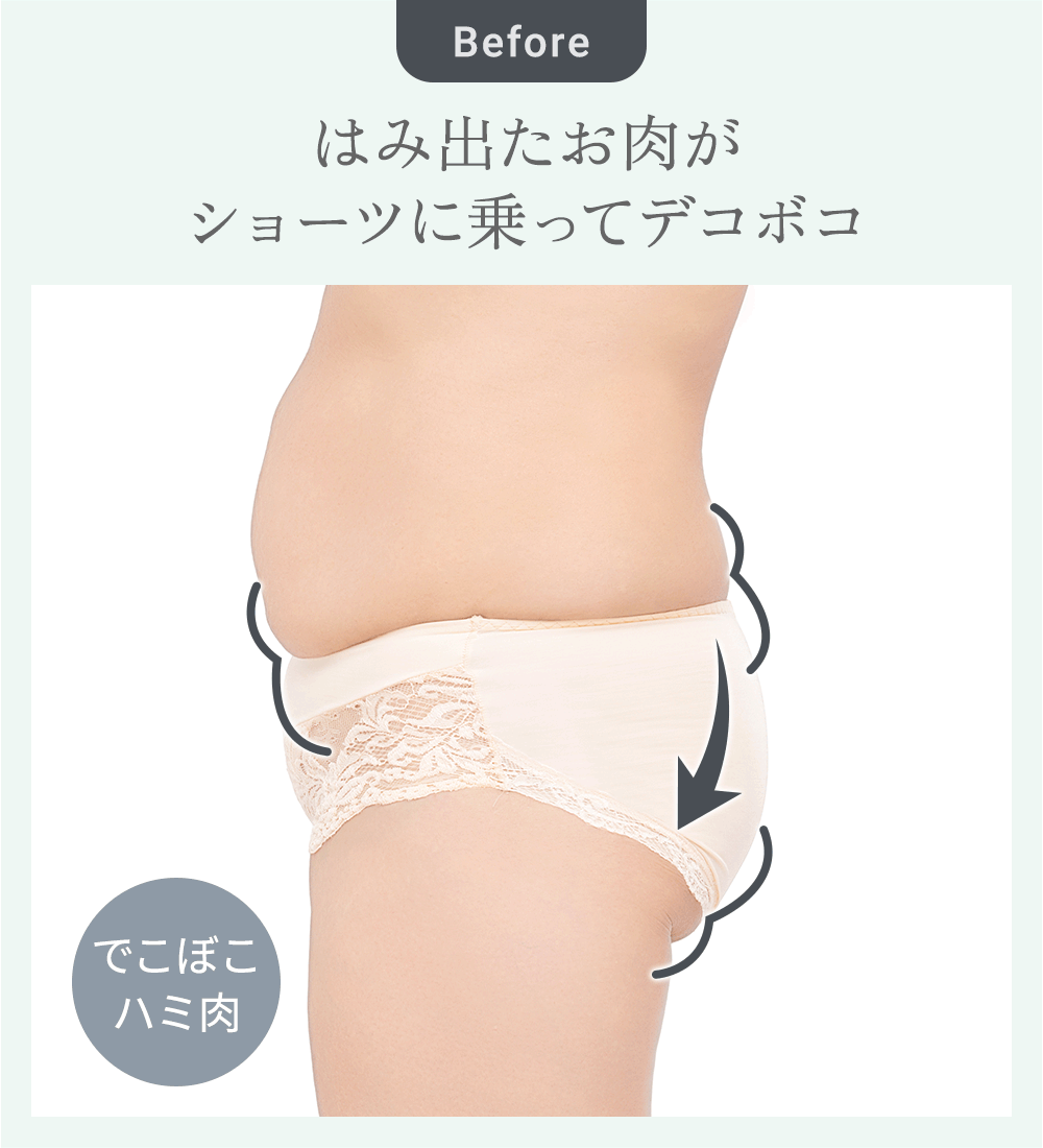 ビフォーアフター