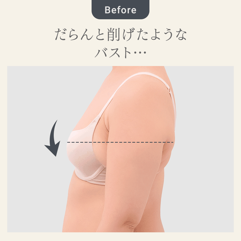 ビフォーアフター