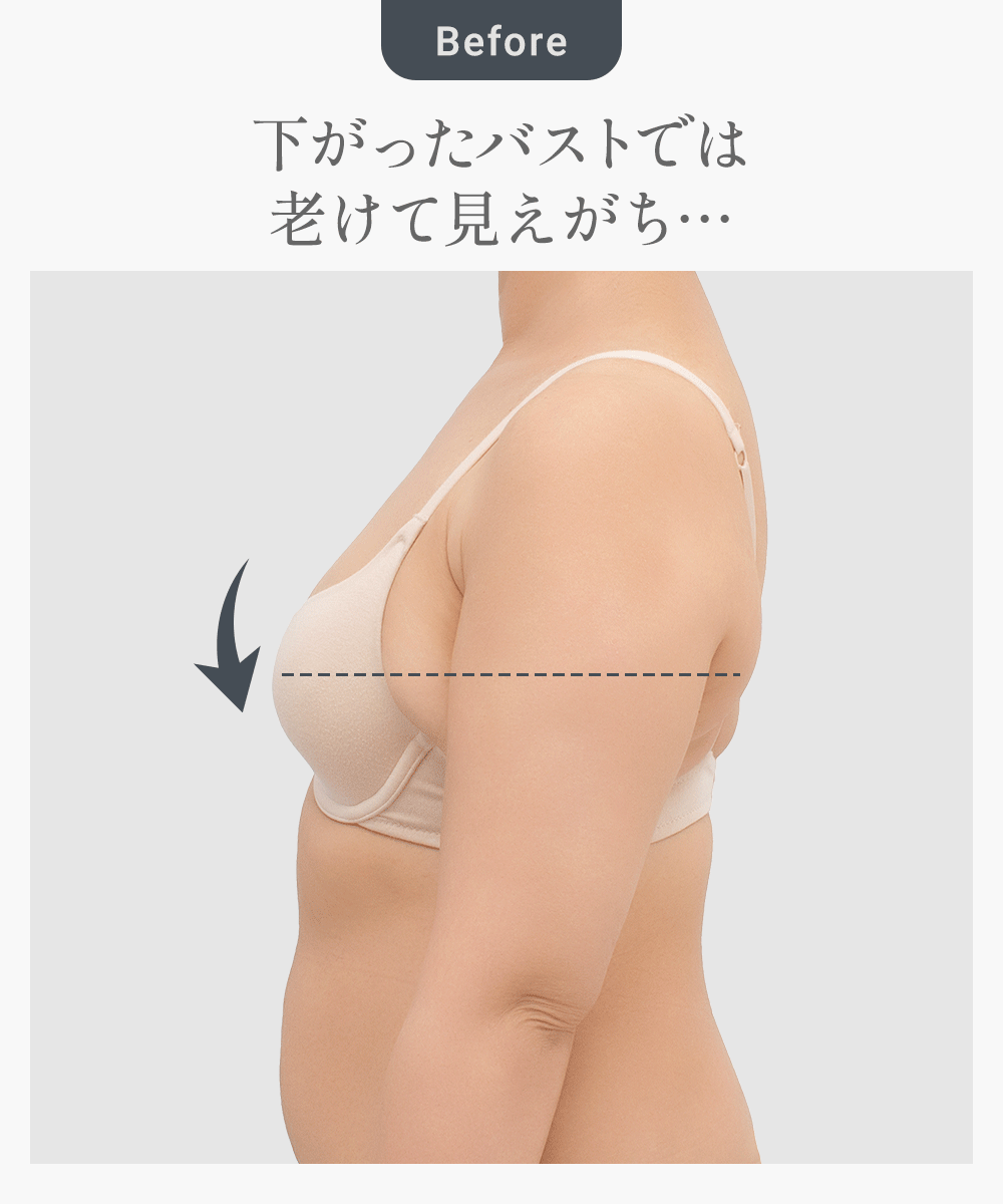 ビフォーアフター