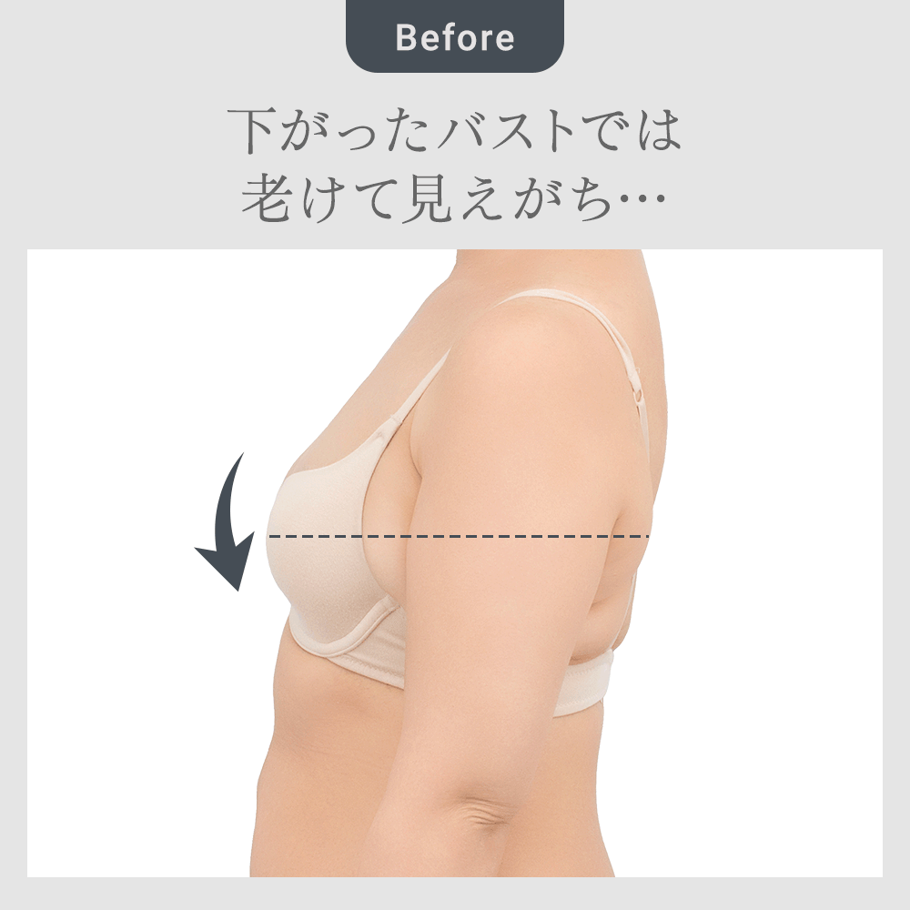 ビフォーアフター