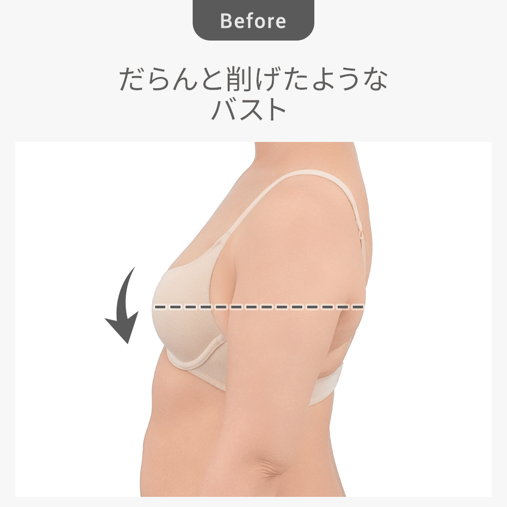 ビフォーアフター