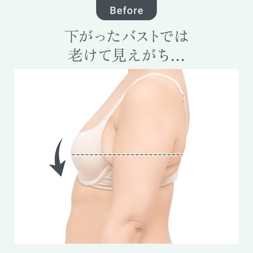 ビフォーアフター