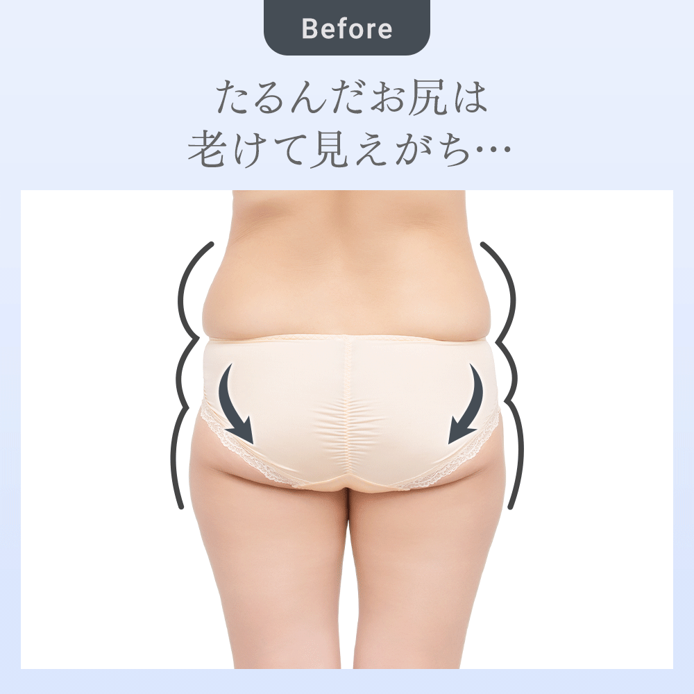 ビフォーアフター