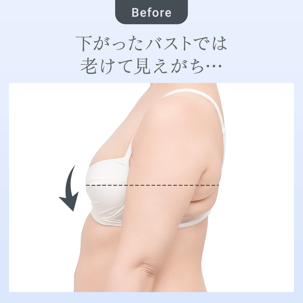 ビフォーアフター