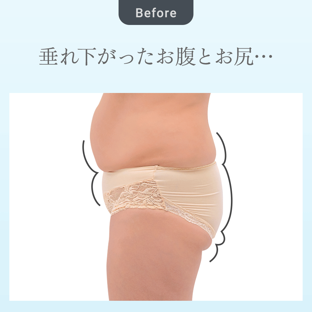 ビフォーアフター