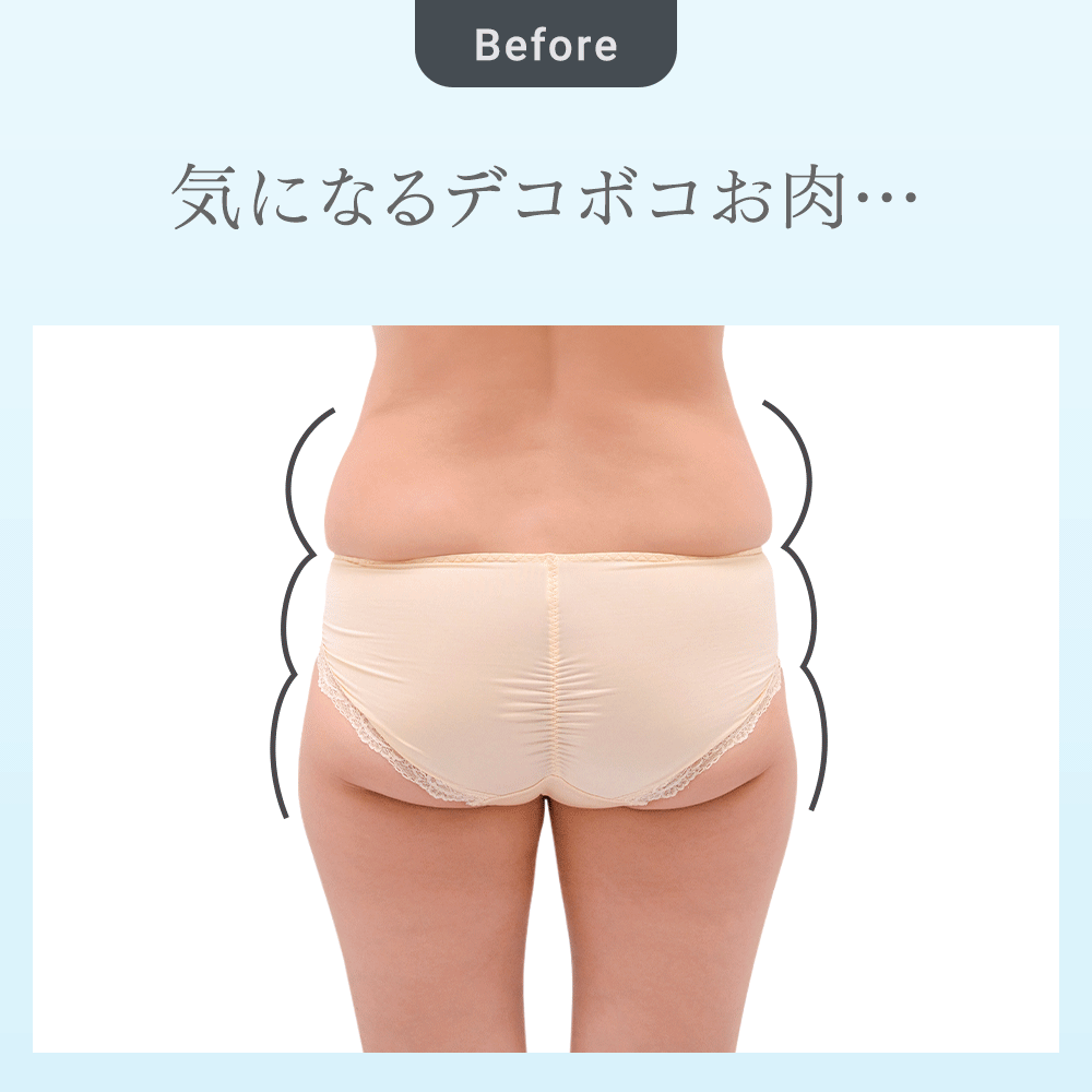 ビフォーアフター