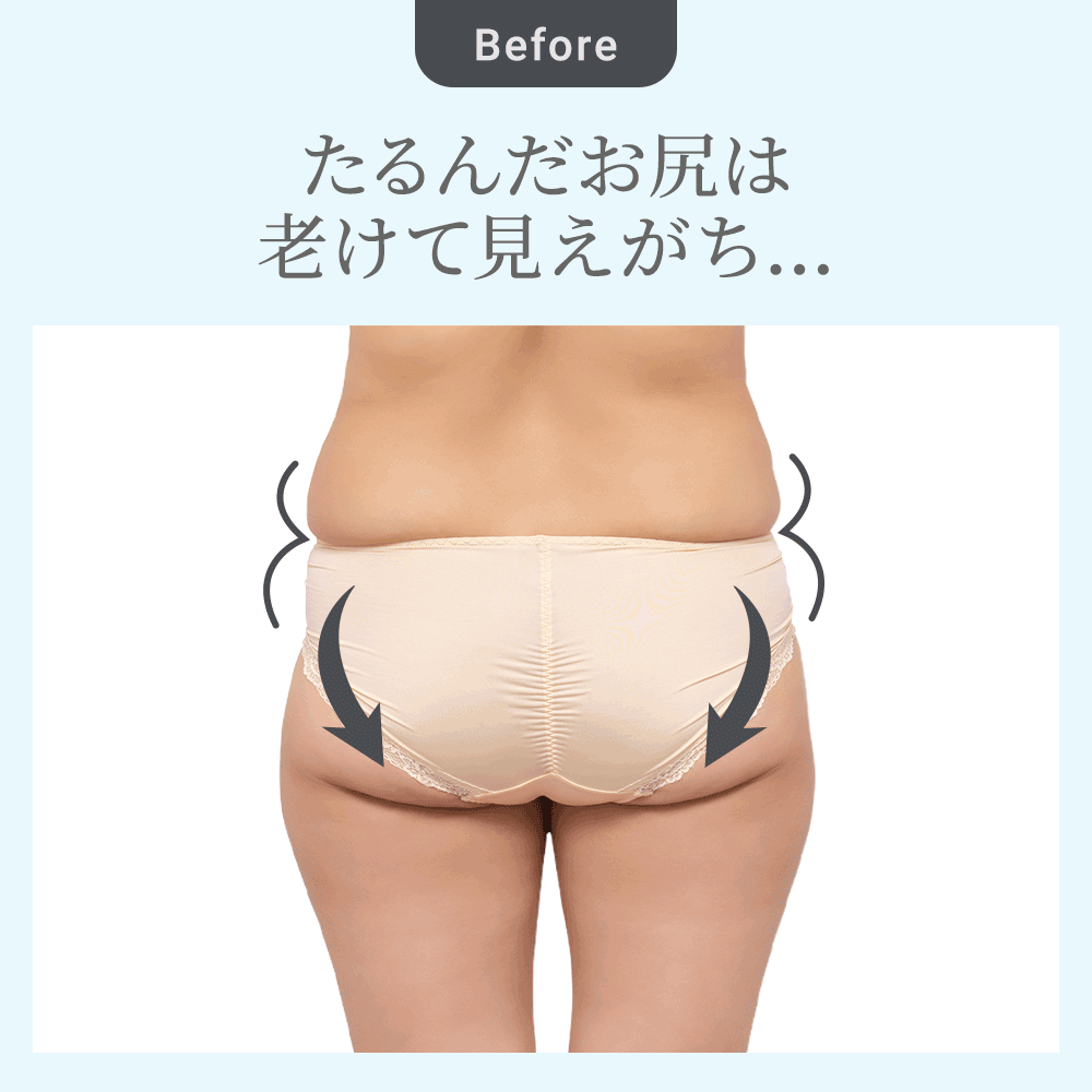 ビフォーアフター