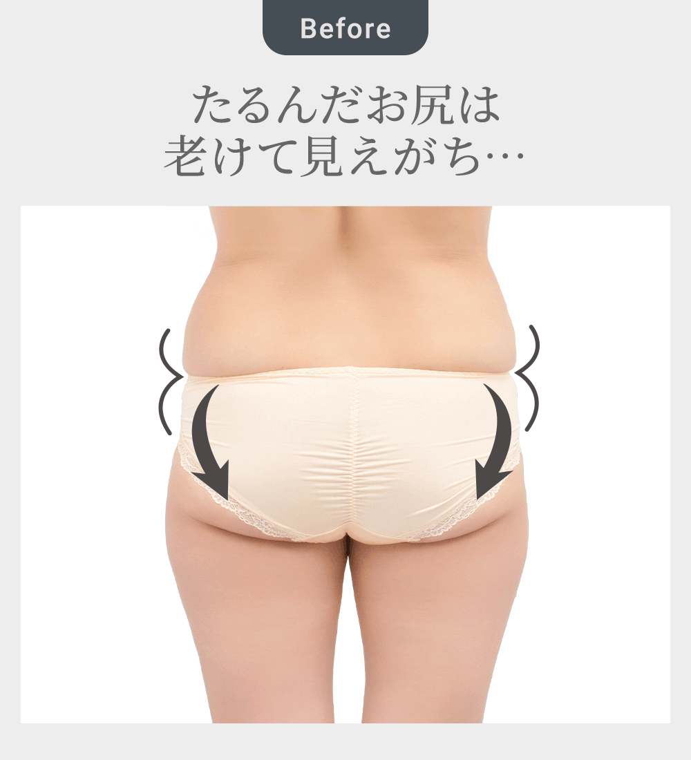 ビフォーアフター