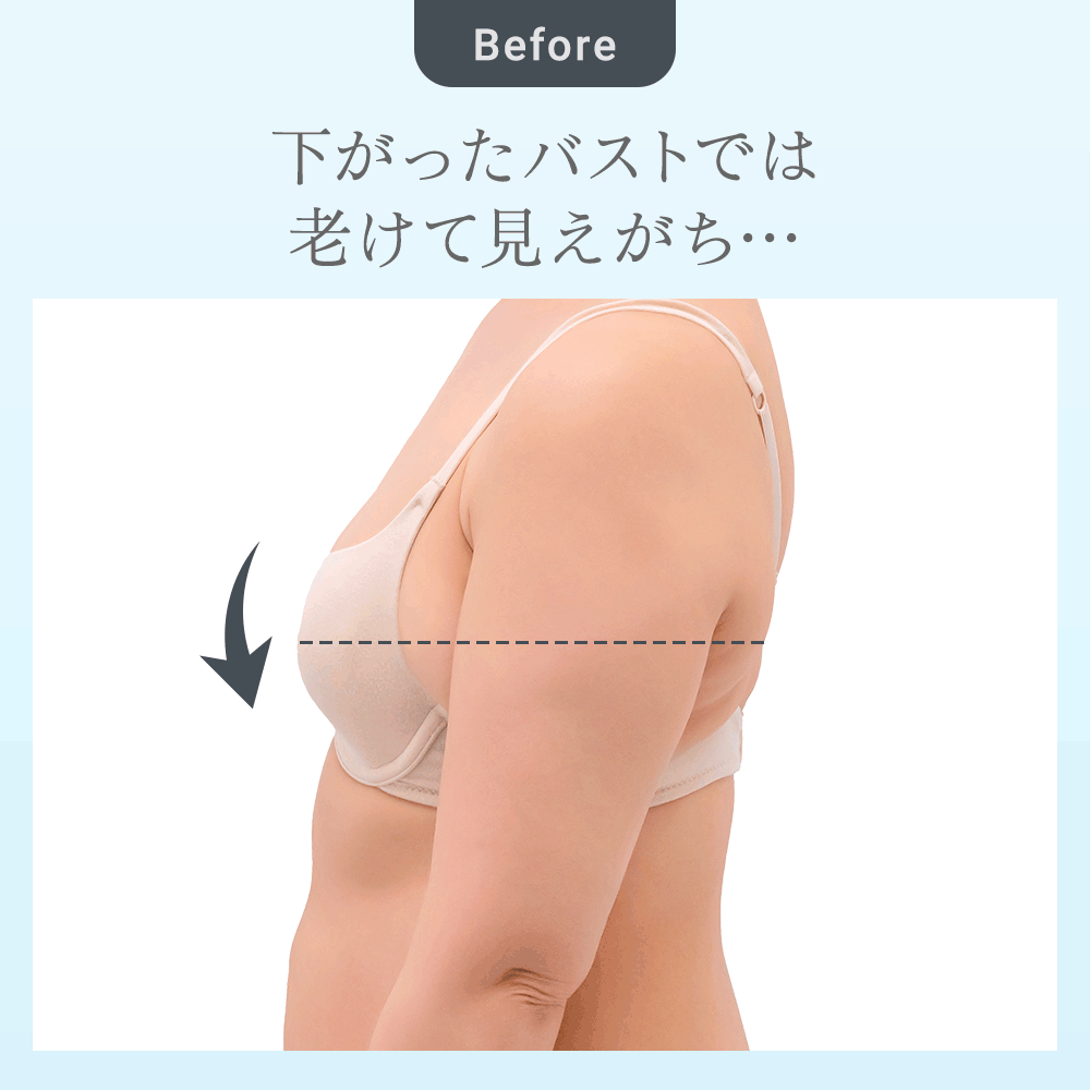 ビフォーアフター