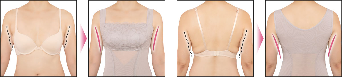 補正ブラキャミのビフォーアフター