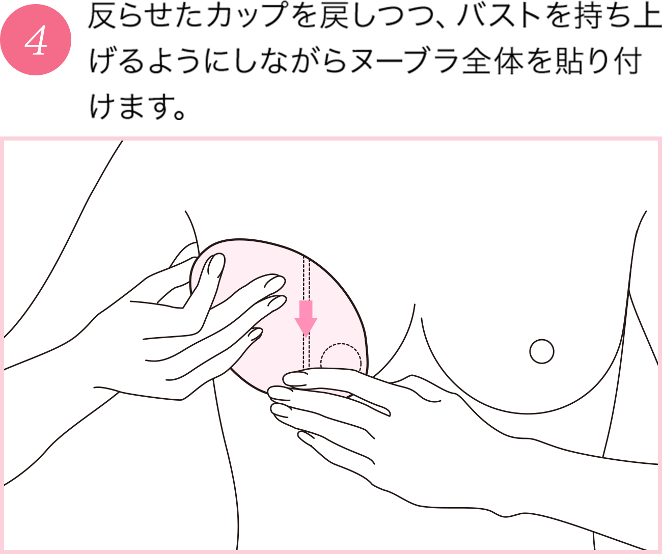 反らせたカップを戻しつつ、バストを持ち上げるようにしながらヌーブラ全体を貼り付けます。