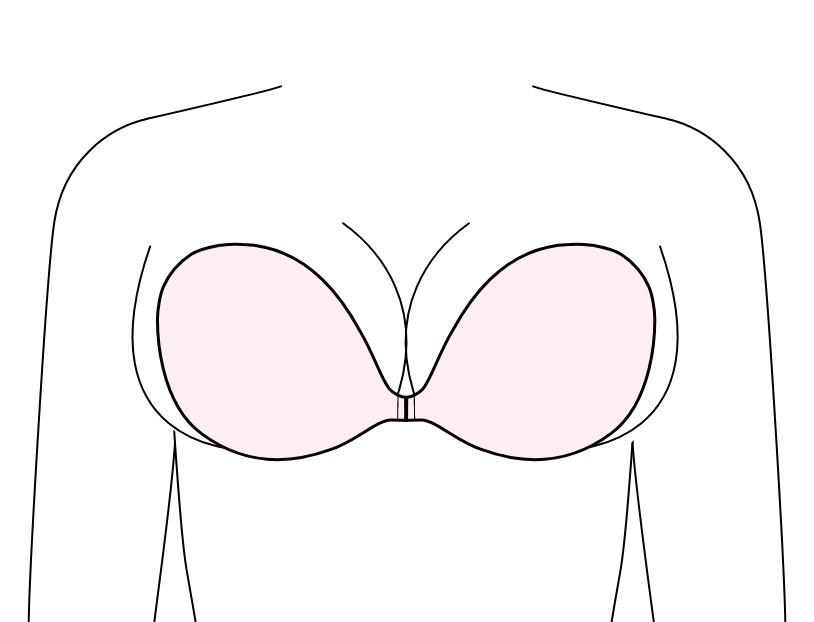 バストがカップから溢れるのはサイズが小さいサイン（ブラフィッティング例）