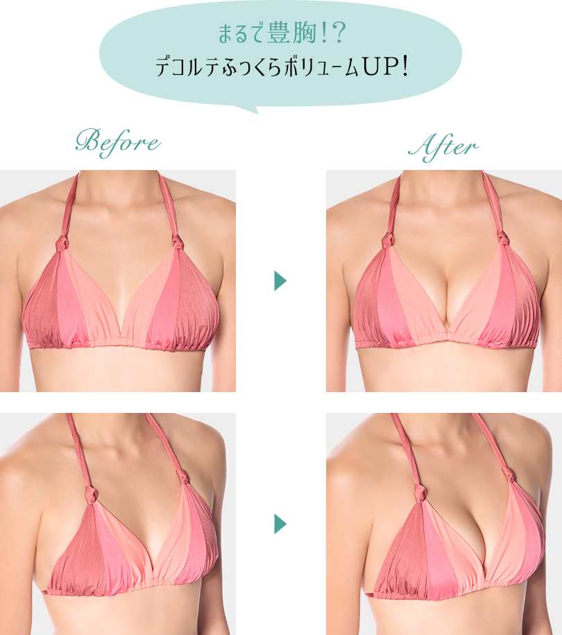 まるで豊胸!?デコルテふっくらボリュームUP!ビフォーアフターイメージ画像