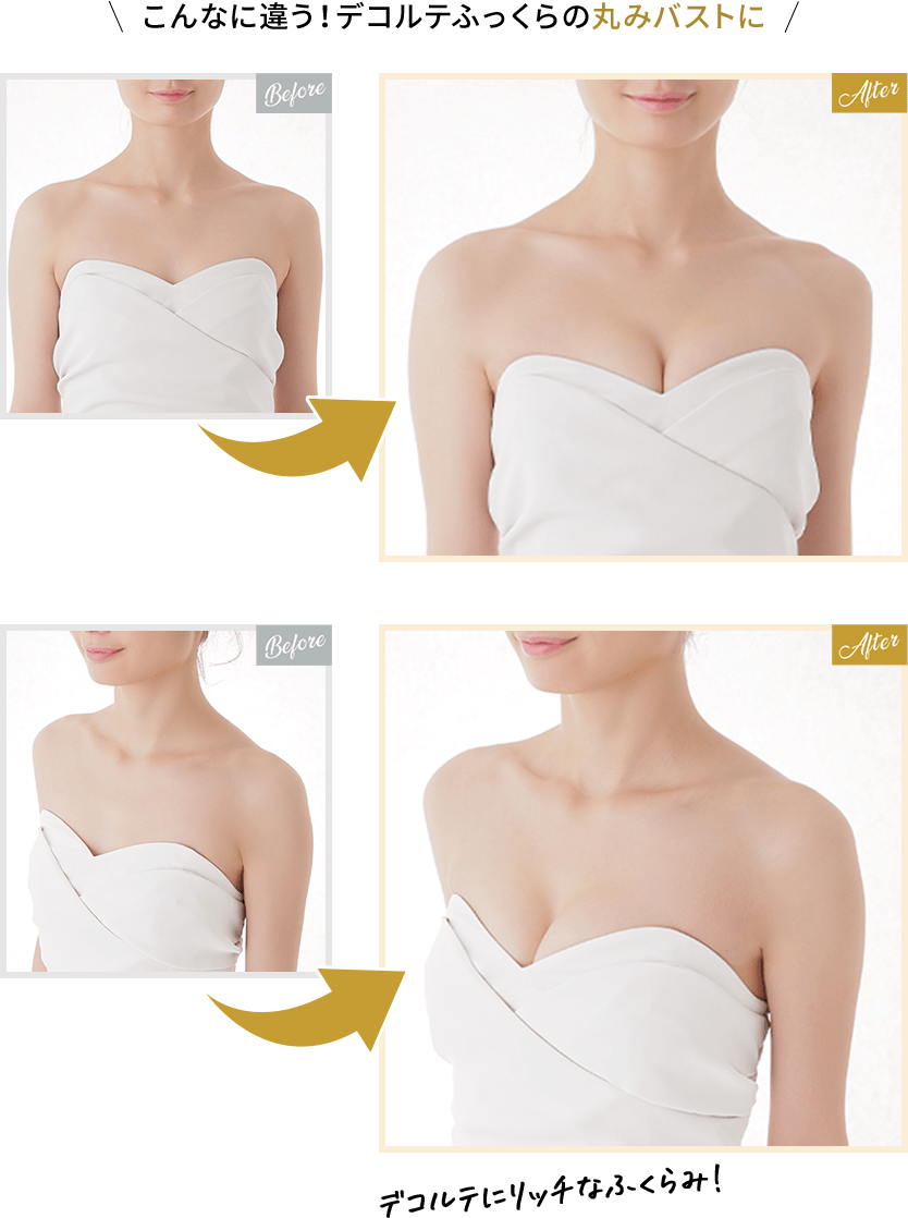 こんなに違う！デコルテふっくらの丸みバストに