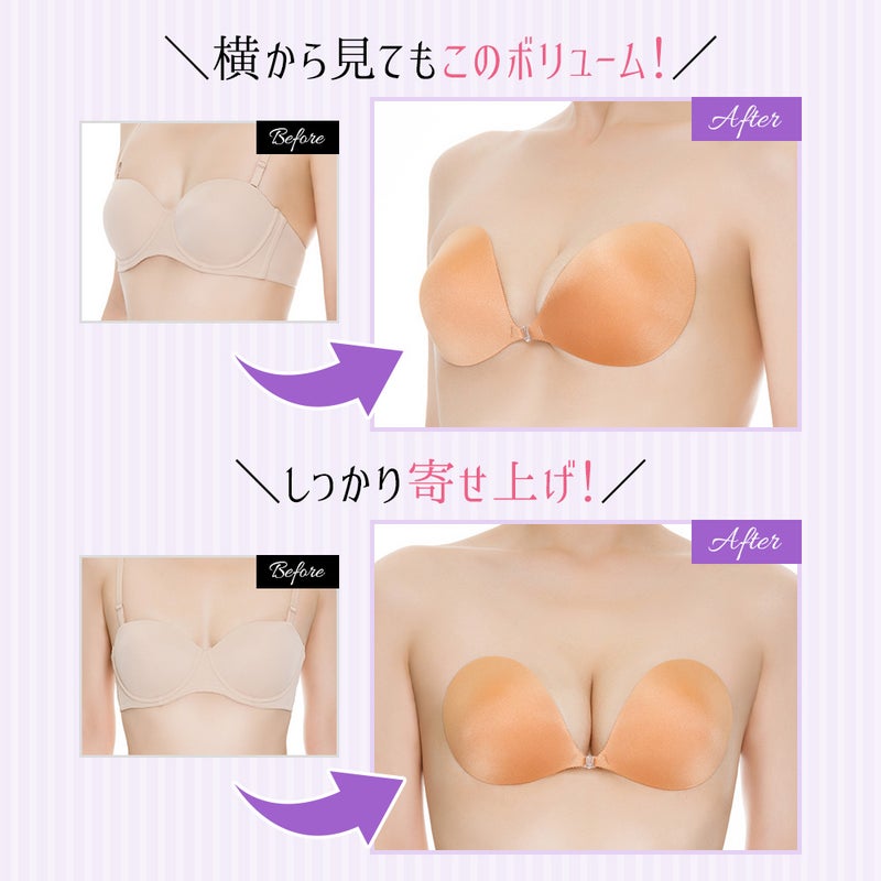 ビフォーアフター