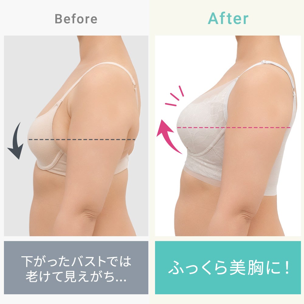 ビフォーアフター