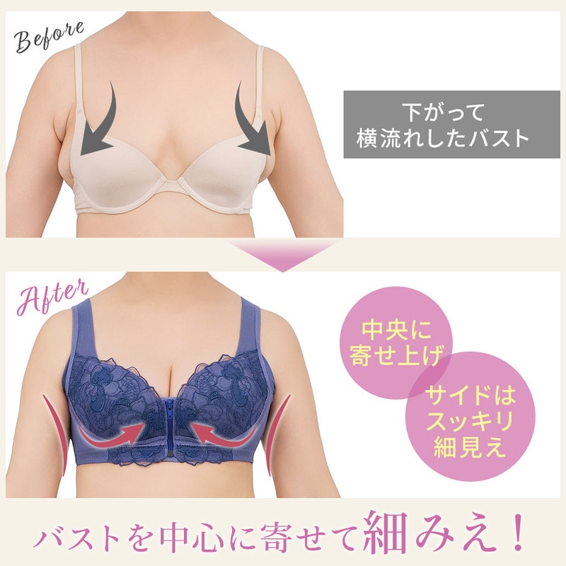 ビフォーアフター